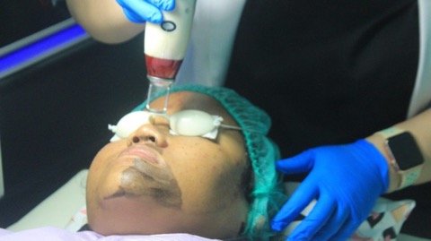 Wajah Bakal Glowing Perawatan Rutin di Mutiara Aesthetic Clinic