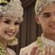 Mahar Menikah Al Ghazali dan Alyssa Daguise: 2025 Euro Berapa Rupiah?