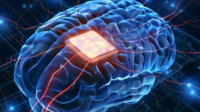 China berhasil membuat chip ke otak dalam uji klinis pertama