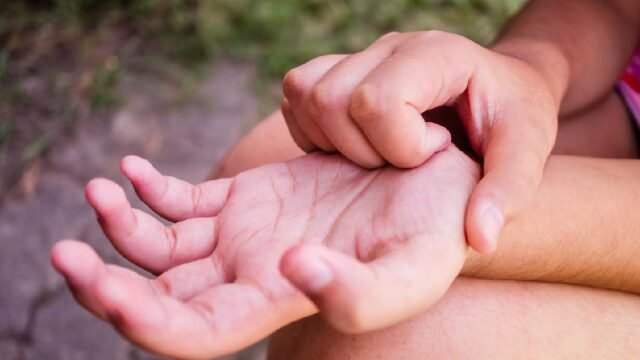 Banjir Rob Parah di Pesisir Kabupaten Bekasi Picu Keluhan Gatal dan Kutu Air